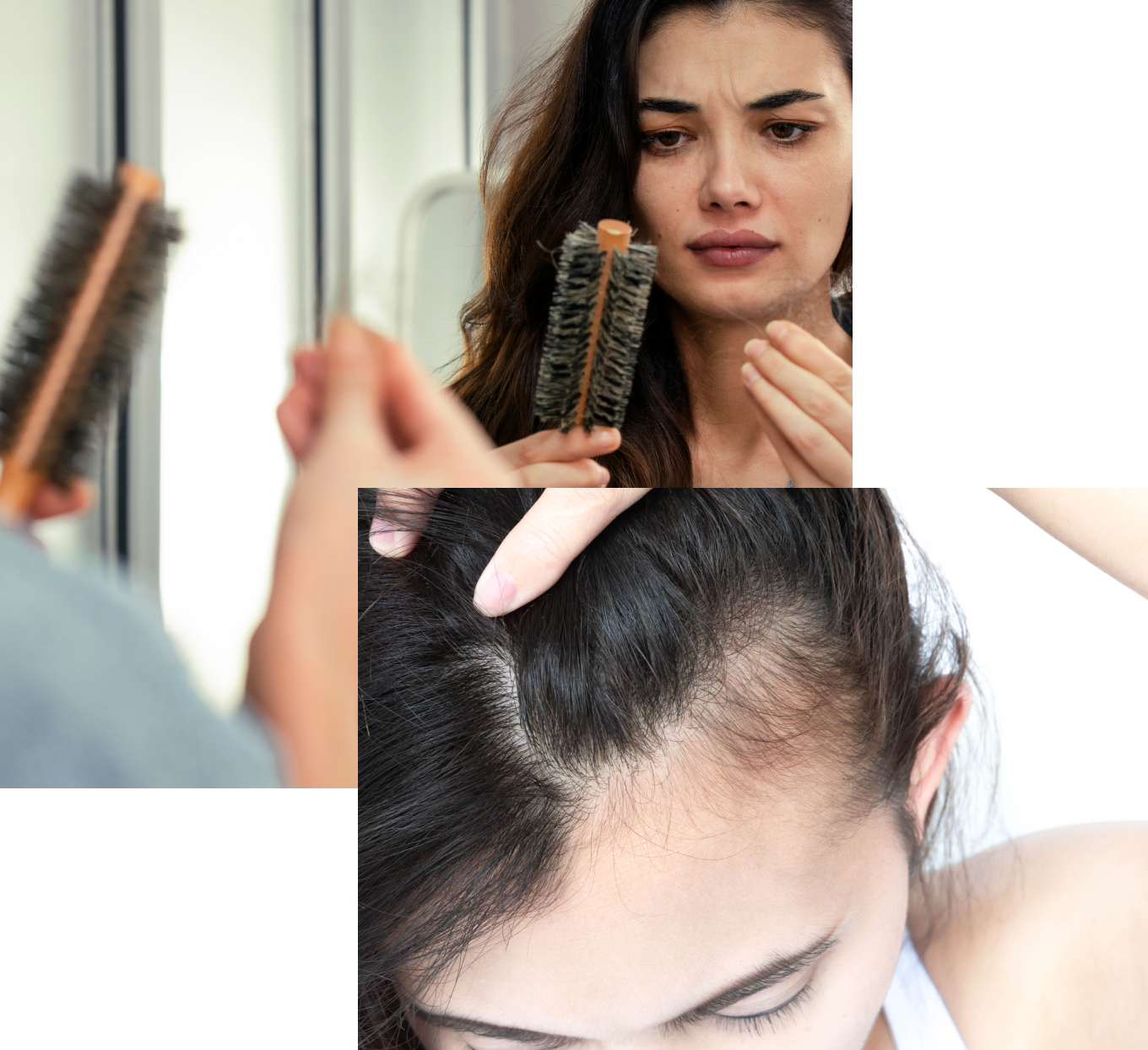 female_hairloss1