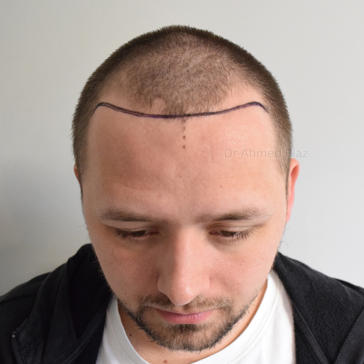 Before image