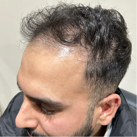 Before image
