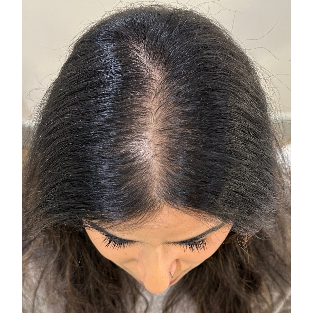 Before image