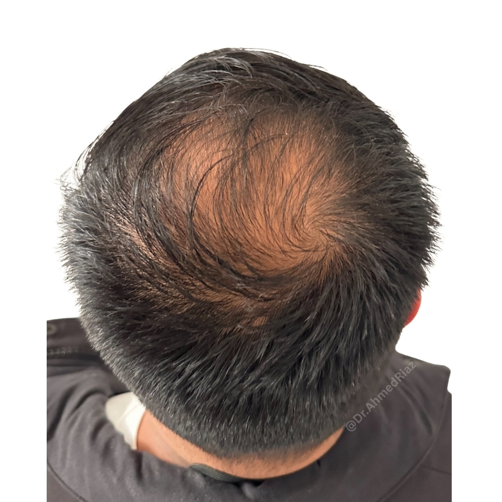 Before image