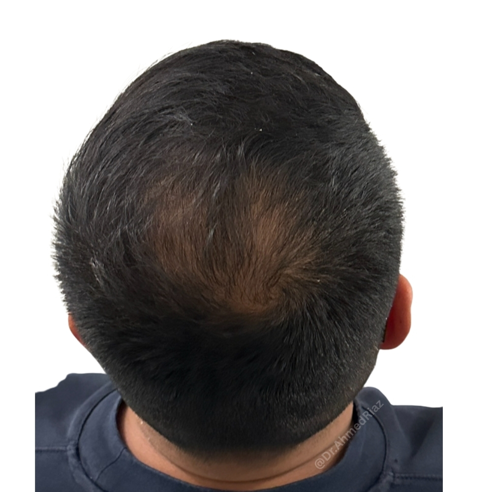 After image