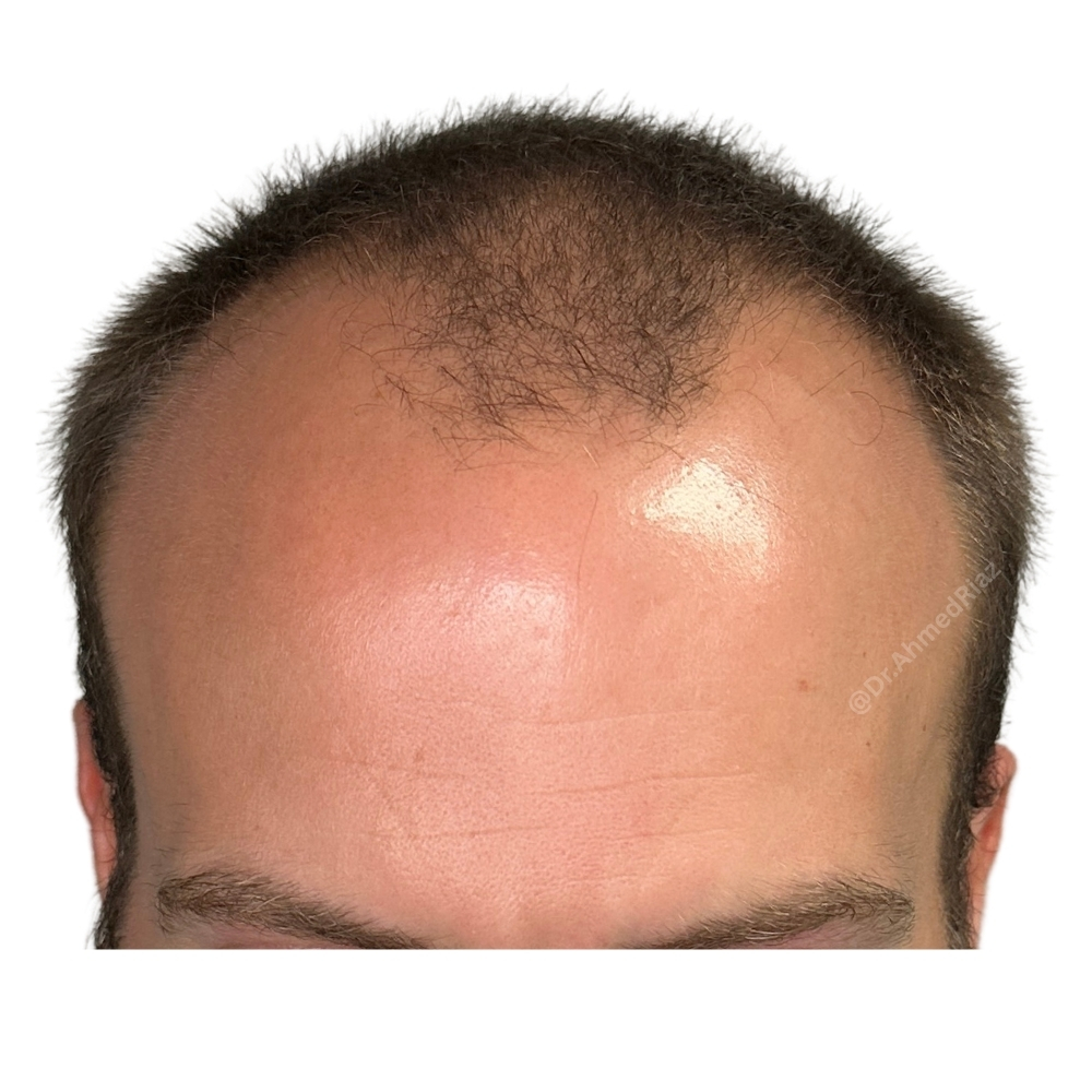Before image