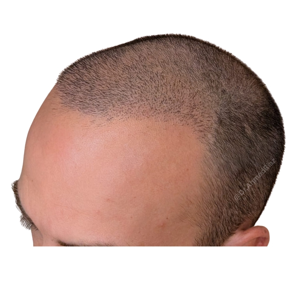 result