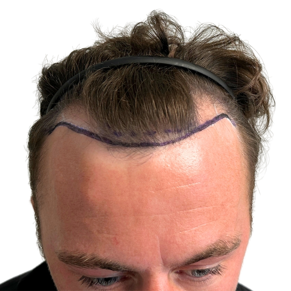 Before image