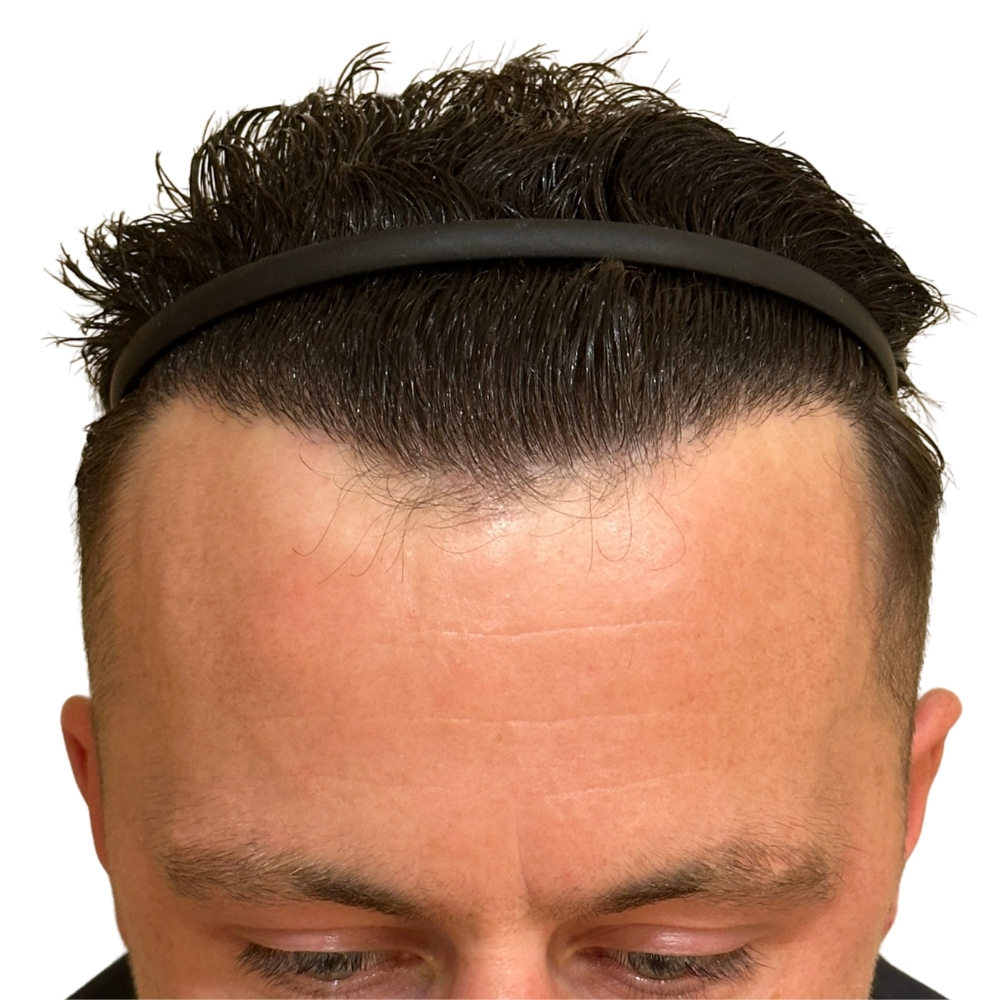 After image