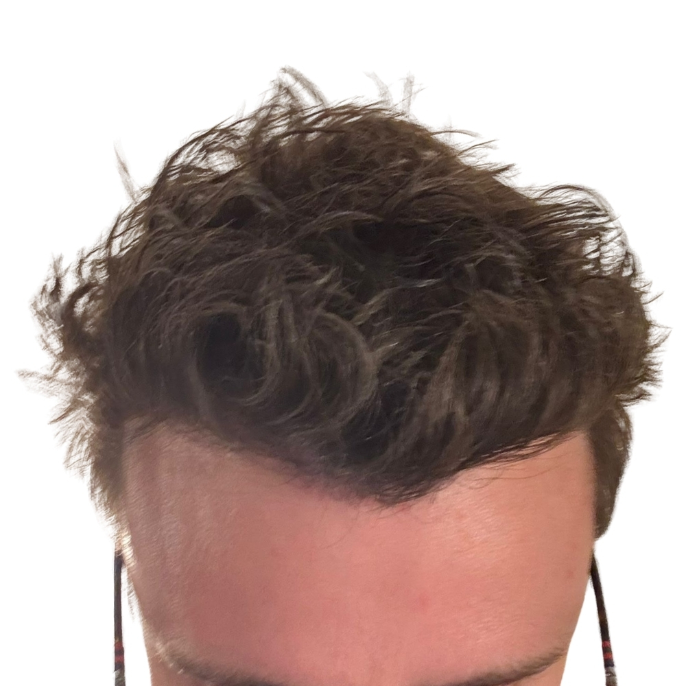 After image