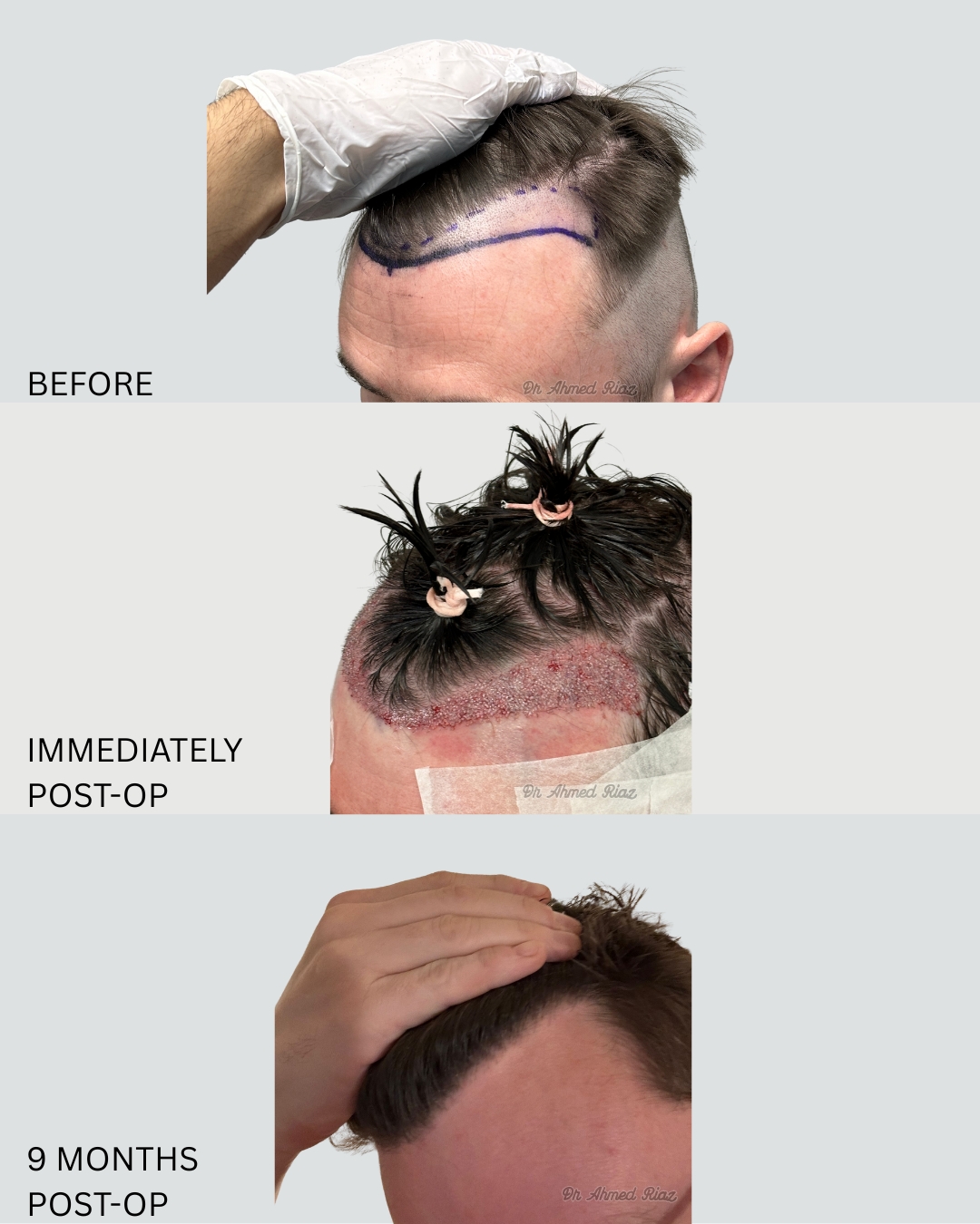 result